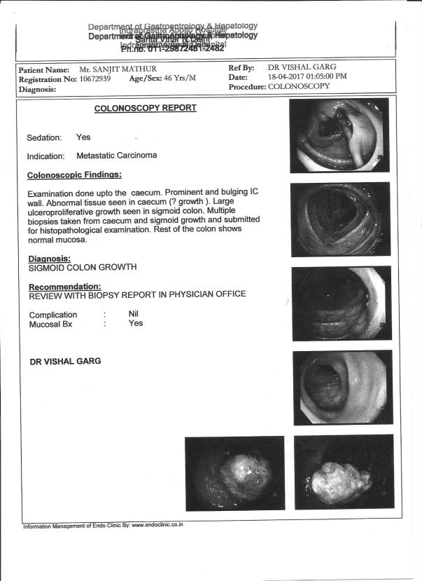 COLONOSCOPY REPORT (WITH TUMOR)