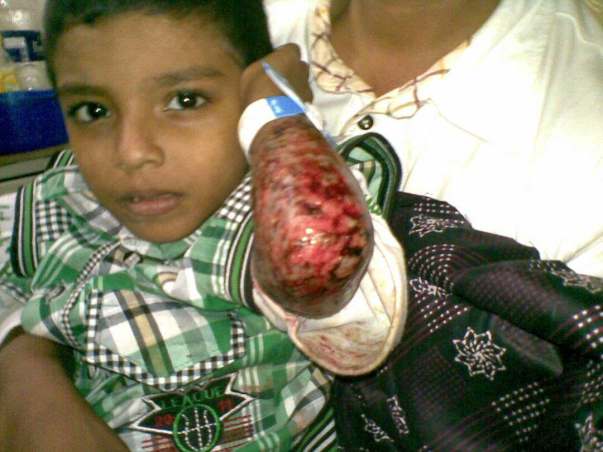 from hospital