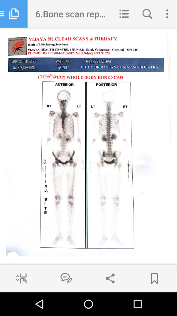 Bone test