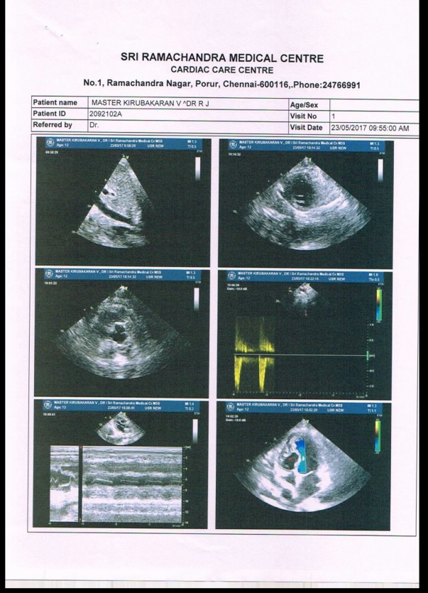 Heart scan report