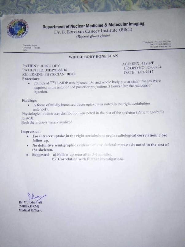 radiation treatment