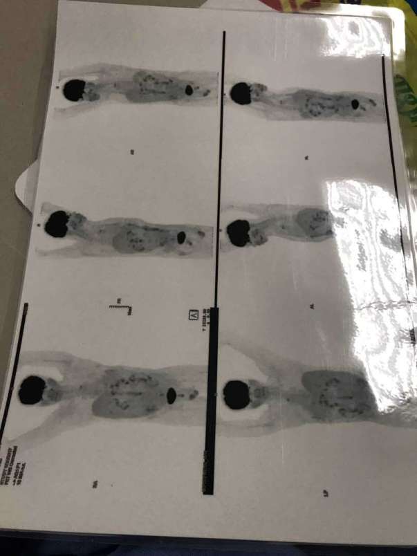 Cancer Report - 1
