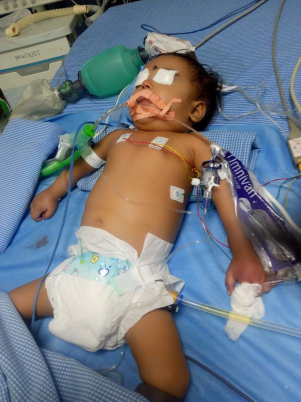 Currently admitted in PICU Rainbow Hospital, Banjara Hills, Hyderabad