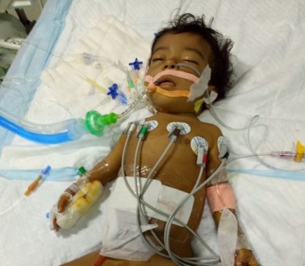 After Liver Transplantation- Currently in ICU