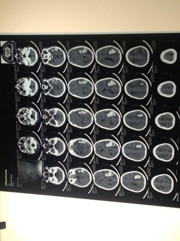 Nair hopsital 12