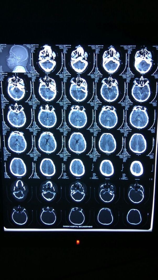 X-ray