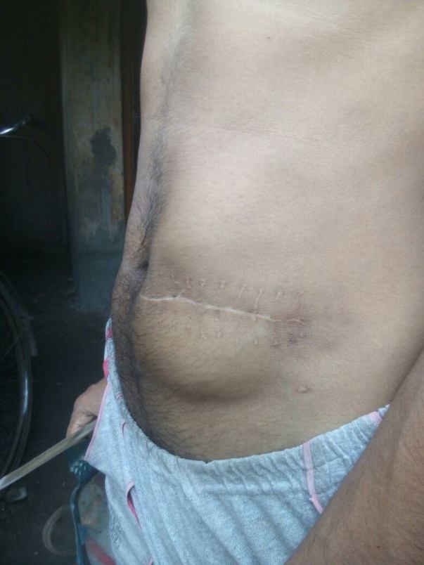 Deformative skull kept in his stomach (Body Temperature)