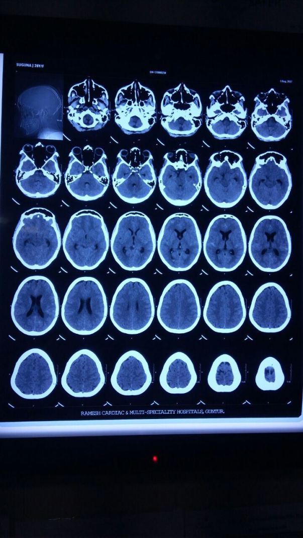 CTA BRAIN -2