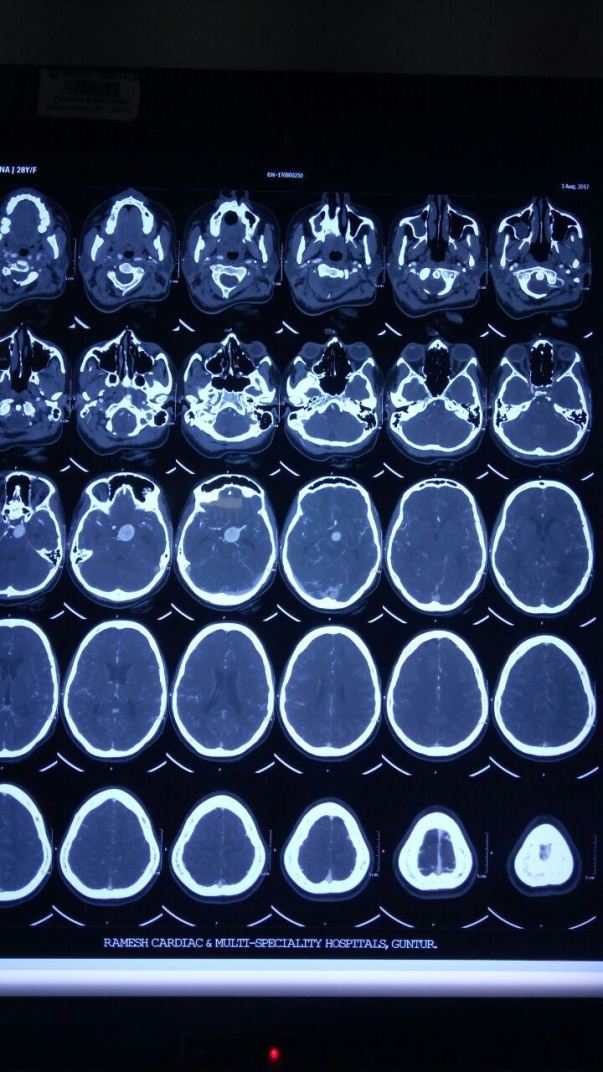 CTA BRAIN -3