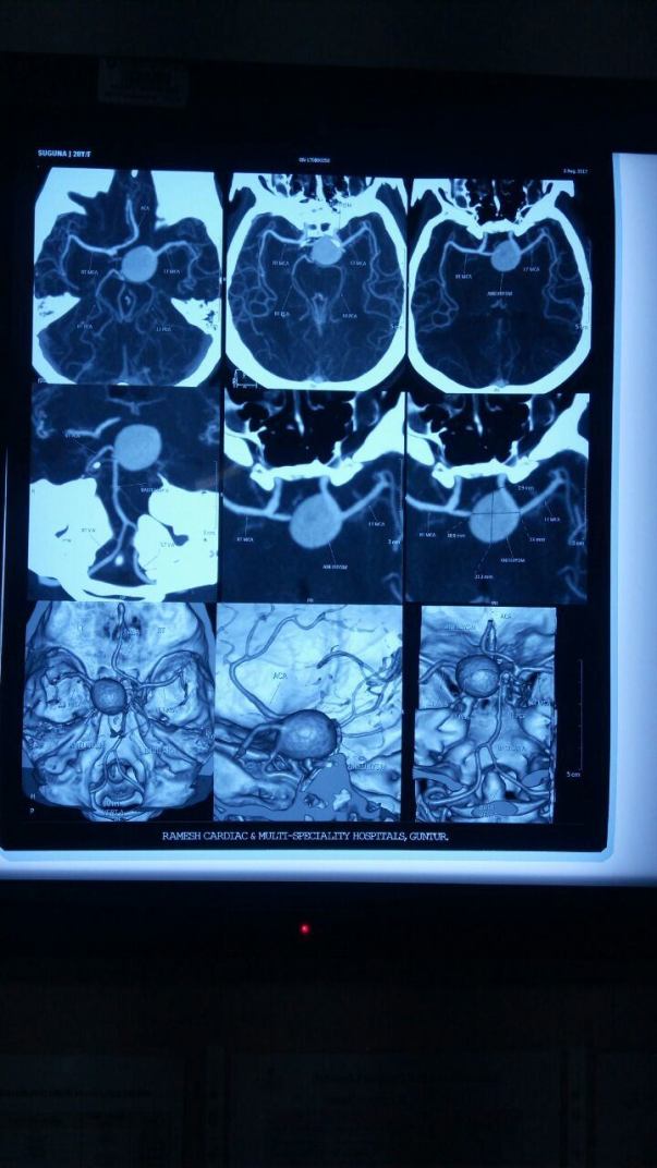 CTA BRAIN -4