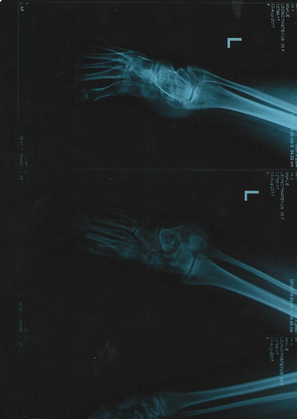 Leg X-ray