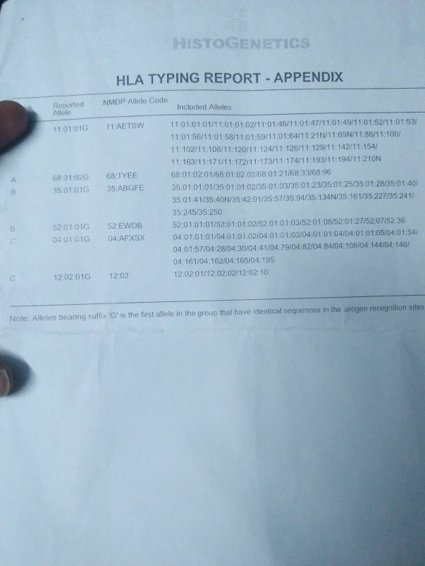 HLA REPORT