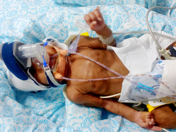 Support For Baby Of Chitra