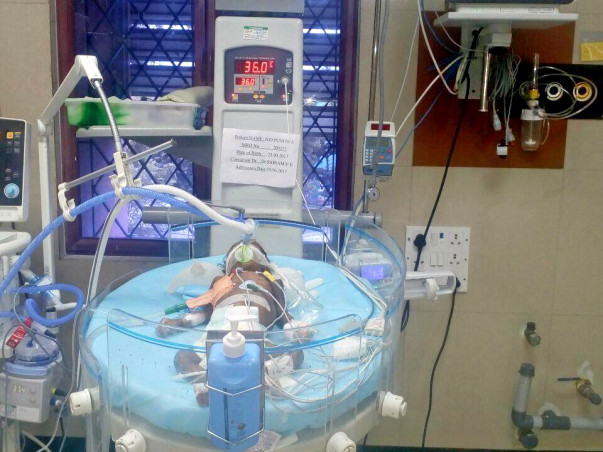 Urgent: Please save three months kid life