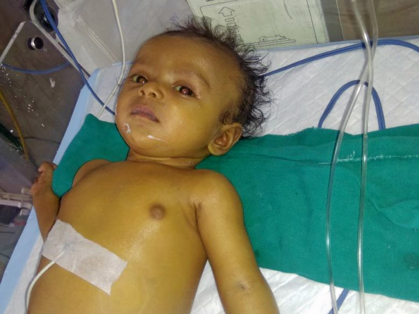 Help 7 Month Baby Undergo A Liver Transplant