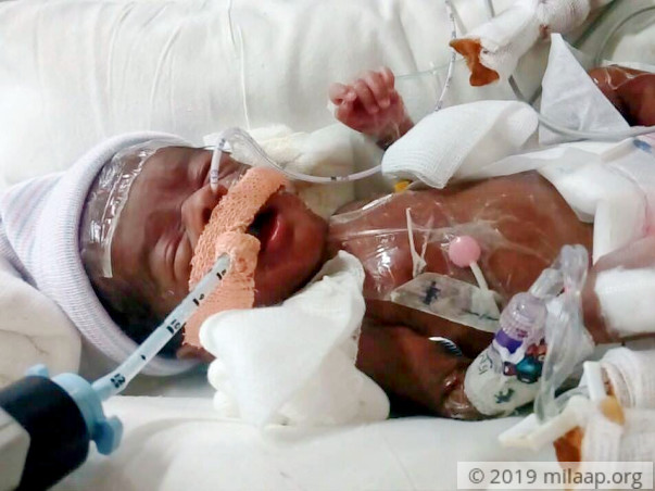This 1-Month-Old Is Fighting For His Life In The ICU