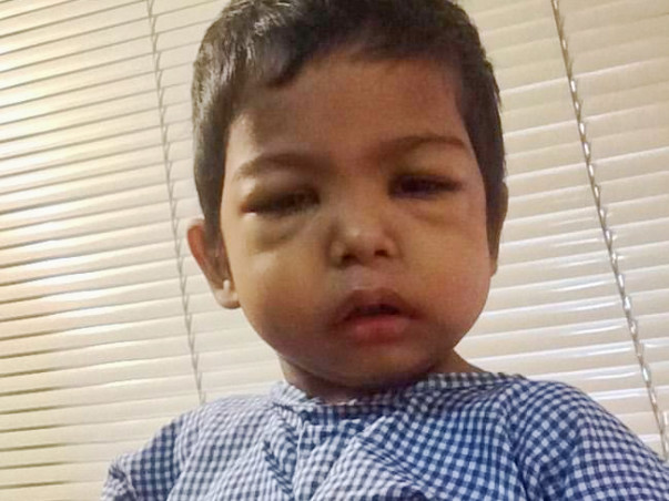 2yrs Baby Fighting with Liver Cell Failure