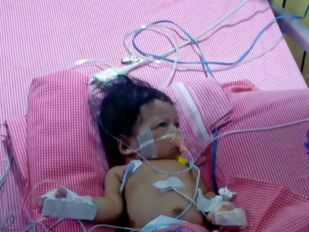 Help Save Baby Yokshitha