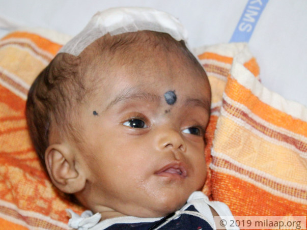 Help 5-month-old Navena suffering from severe brain infection