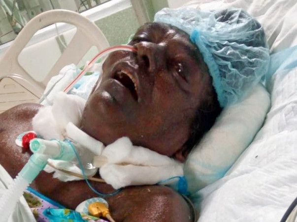 Help My Mother Who Is Suffering From Blood Fungal Infection