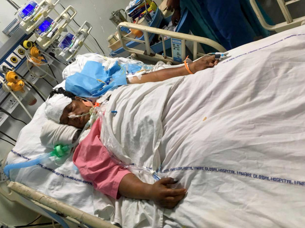 Save A Friend's Mother From Viral Pneumonia Infection (ARDS)