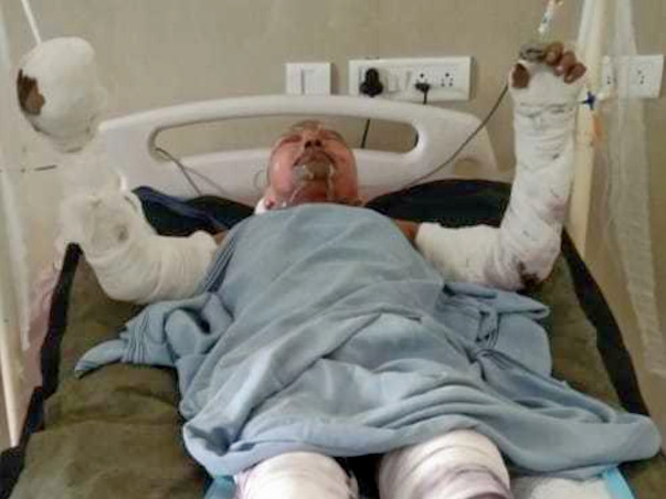Please Help Rajendra Barik Recover
