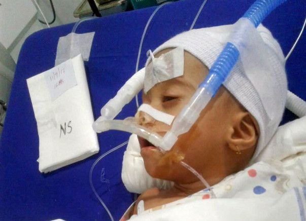 Help Baby Pranjal, Who Was Born With A Heart Defect