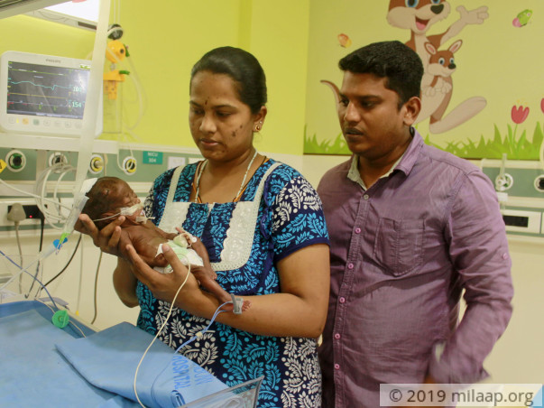 This Couple Fears They Will Lose One Of Their Twin Babies Without Help