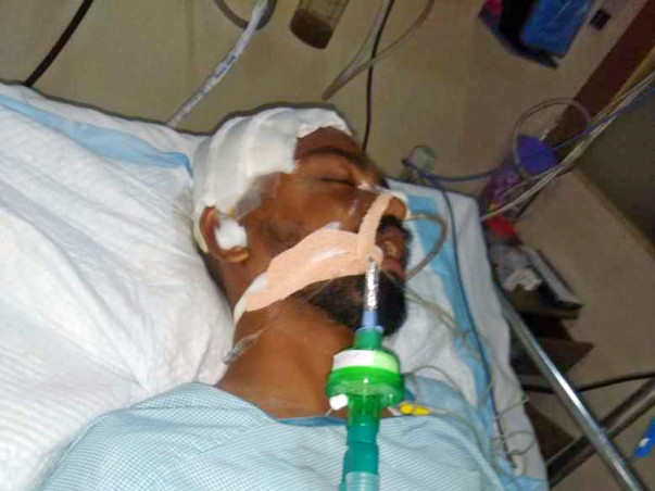 Help Saikiran Who Met With An Accident And Fighting For His Life.