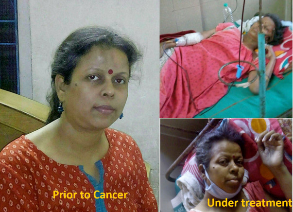 Help Mahua fight Cancer (CLL with p53 mutation)!