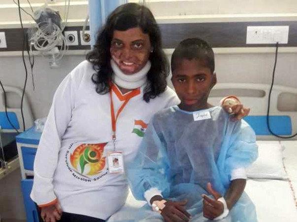 Free Of Cost Surgeries for Burn Survivor (Post Deformities)