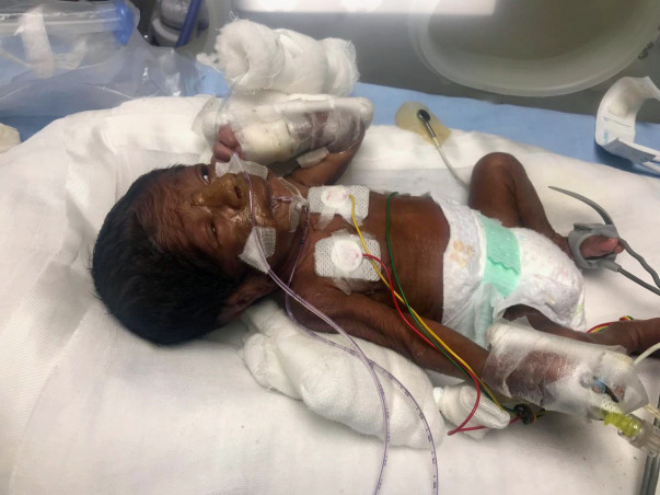 Help Prematurely Born Baby Fighting For Life.