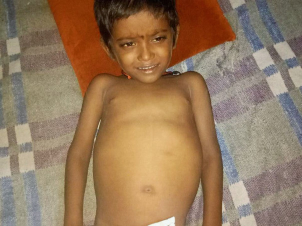 4-year-old Manish urgently needs a liver transplant to survive