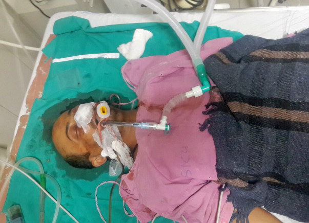I am fundraising to save my Brother life