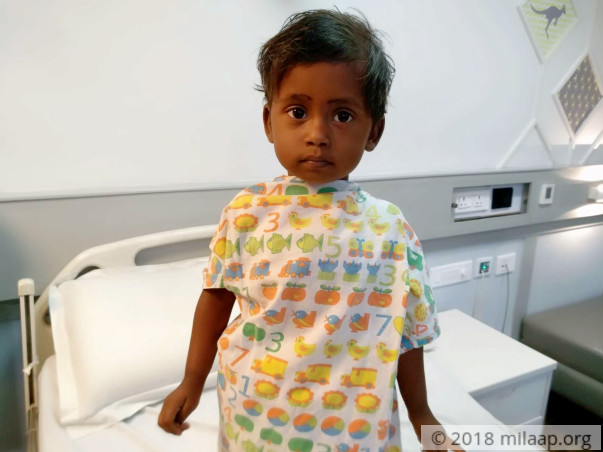 This 2-Year-Old Baby Girl With Four Heart Defects Is Closer To Death