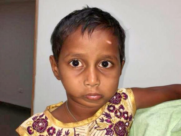 Help Deepa Who Requires A Jaw Surgery To Open Her Mouth