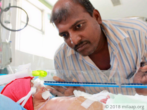 7-Day-Old Twins Need Help To Be Able To Breathe On Their Own And Live