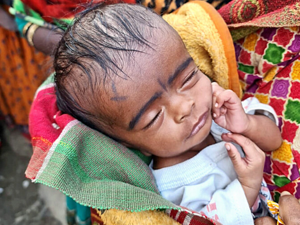 Help! Two-month-old baby Saloni to survive a serious medical condition