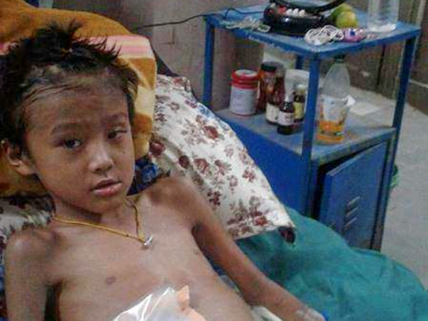 Help this 8 year old brave boy from losing his leg to gangrene