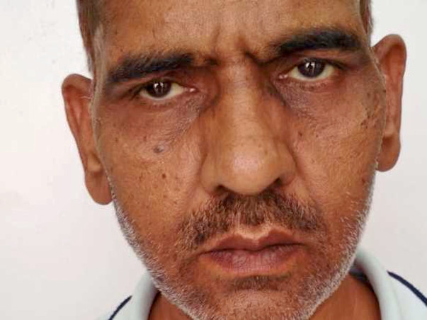 Help Yashwant Dangi Undergo A Liver Surgery