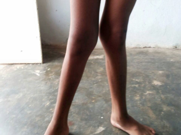 Help Nikhil Undergo Physiotherapy