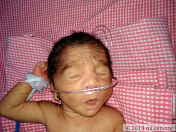 People Refused To Help In Saving This Child Because She Is A Girl