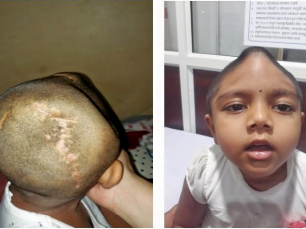 Help for my Little Angel, Ishita.