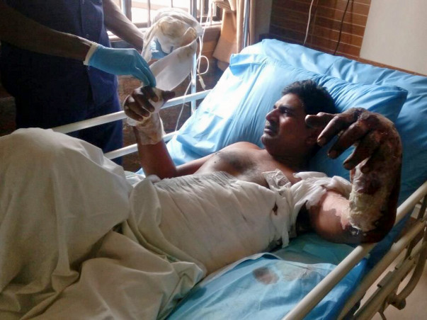 Help Thouhid For Treatment Of Severe Electric Shock