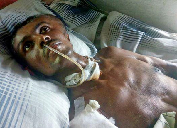 Help Manoj And His Family Live A Life With Dignity