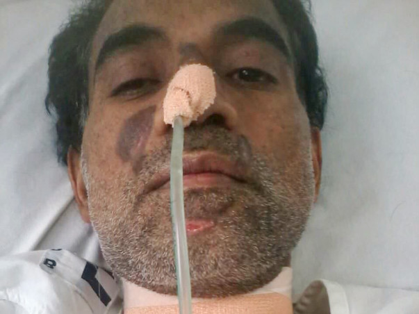 Help alfred lobo from Brain stroke