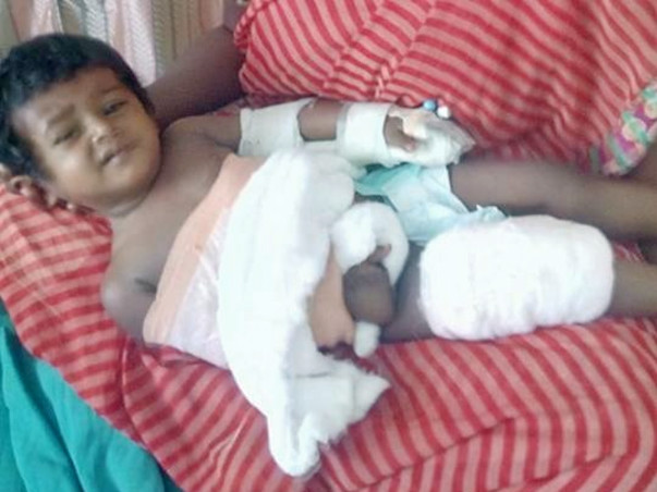 Help Mathulika To Get Her Right Hand