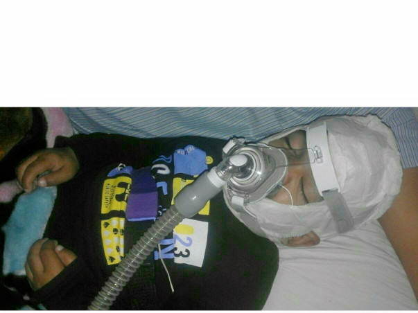 Save Little Shaurya, suffering from a rarest disease "Hunter Syndrome"