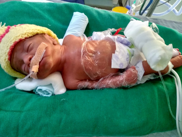 Help My Premature Baby Recover