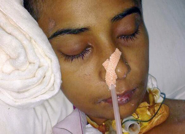 Save Priyanka's Life: Battling "Severe Brain Hemorrhage"